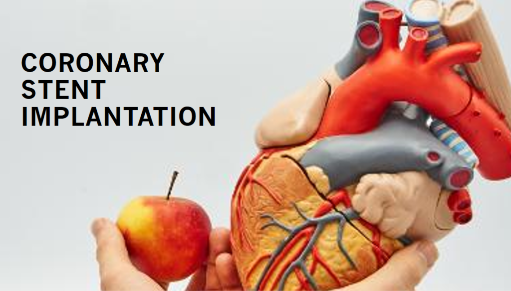 Coronary Stent Implantation