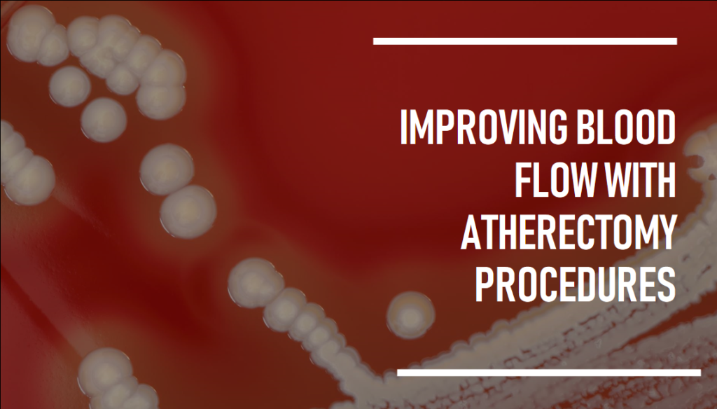 The Benefits of Atherectomy for Improved Blood Flow